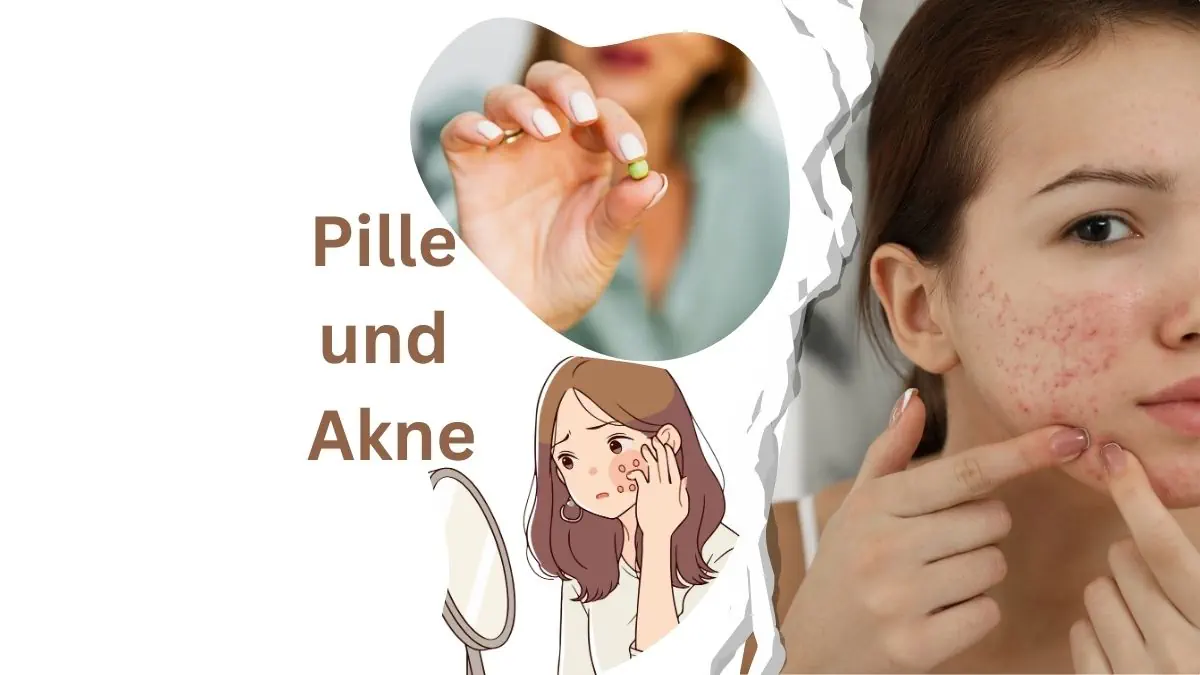 Pille und Akne Ursachen, Wirkung, Risiken & bessere Alternativen: arganim